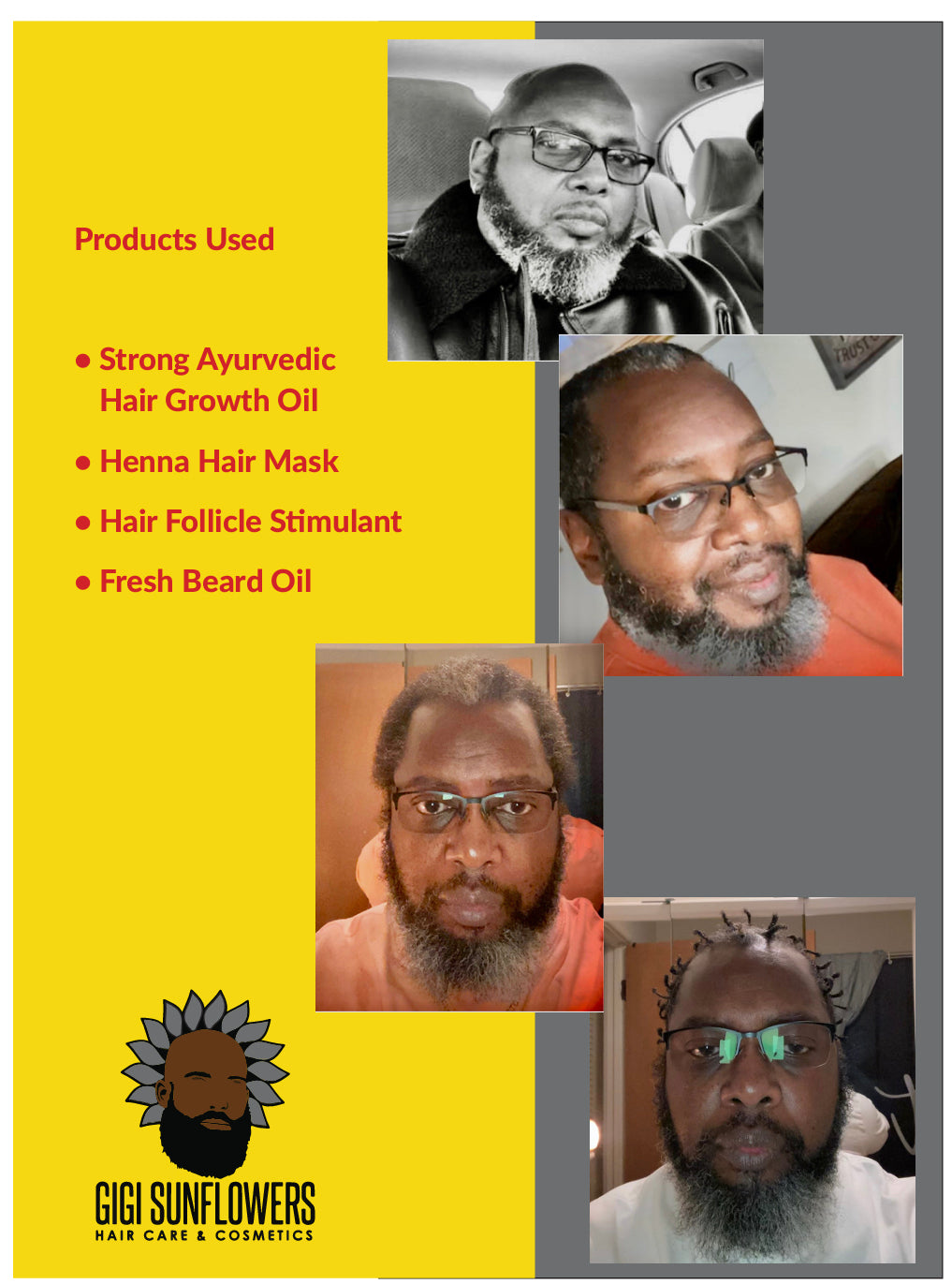 MEN'S 5pack Bundle SCALP HEALING HAIR GROWTH KIT