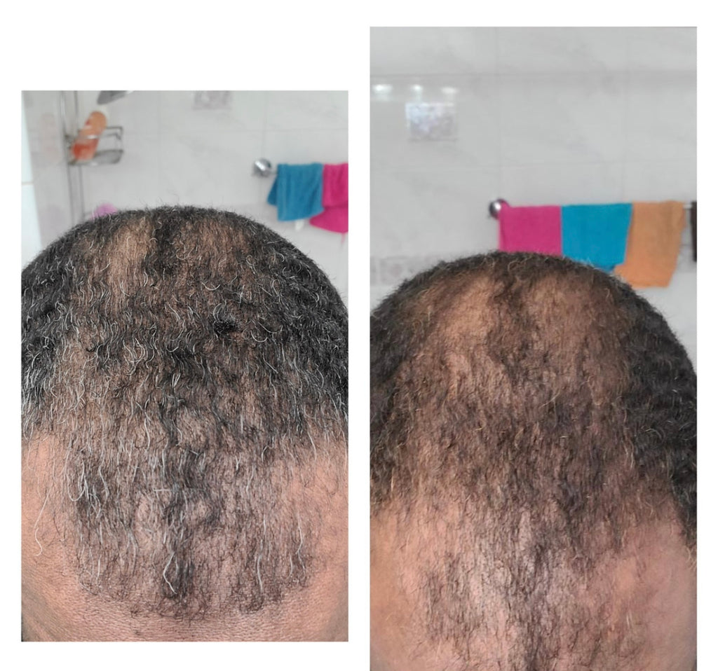 2 Pack Moisture Bundle