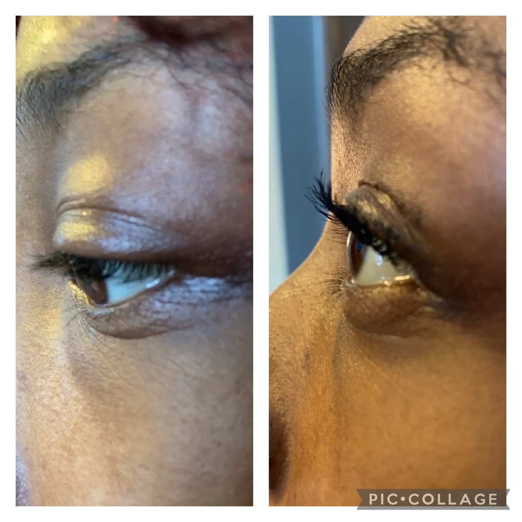 Eyelash Growth Treatment